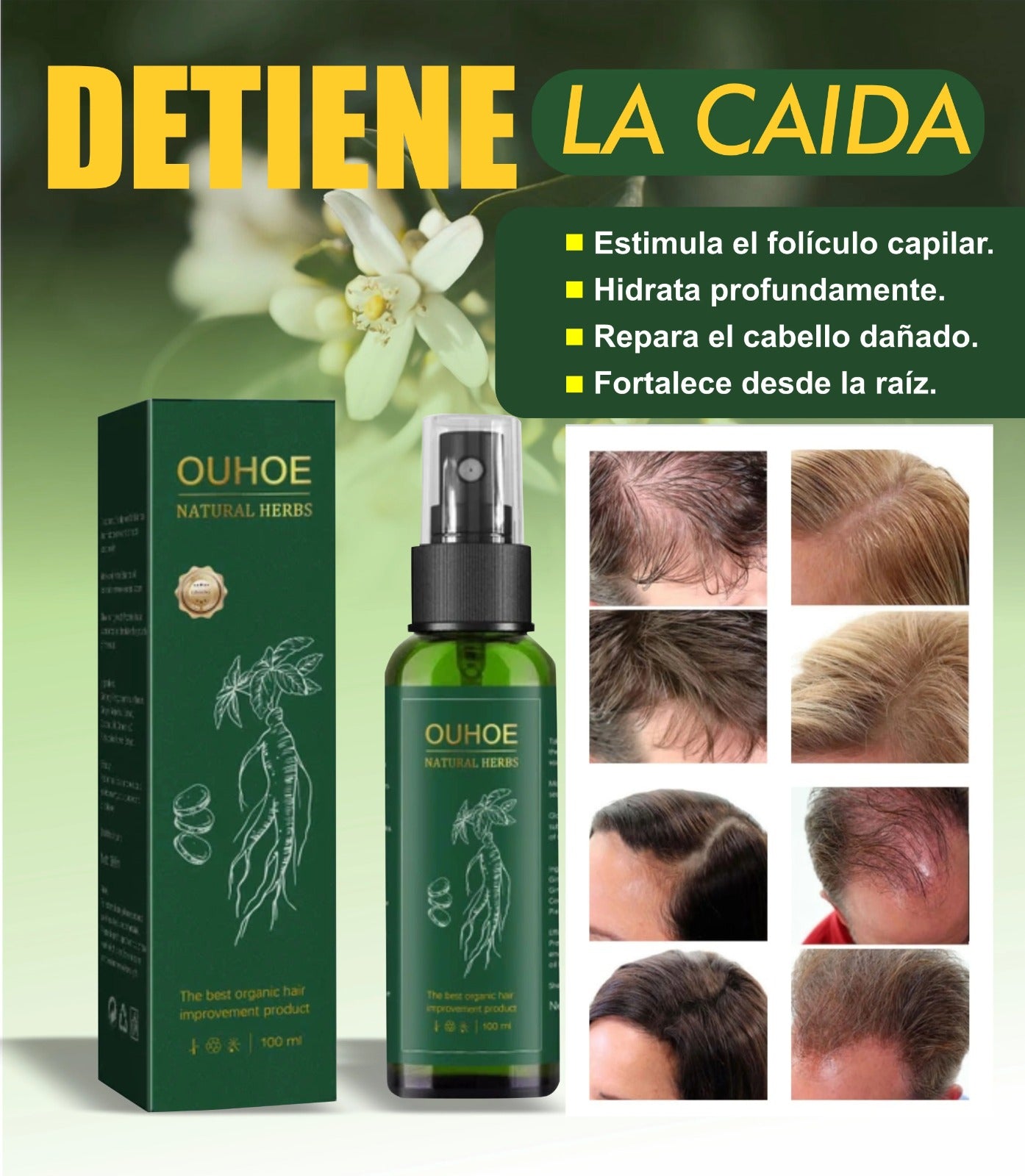 OUHOE ™-CRECIMIENTO DE CABELLO TK